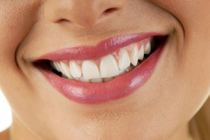 Instantly Enhance Your Smile with Snap-On Smile